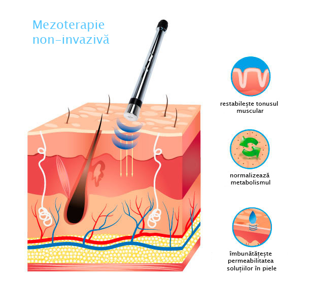 S-02 Dispozitiv cosmetic multifuncțional Alvi-Prague mezoterapie non-invaziva