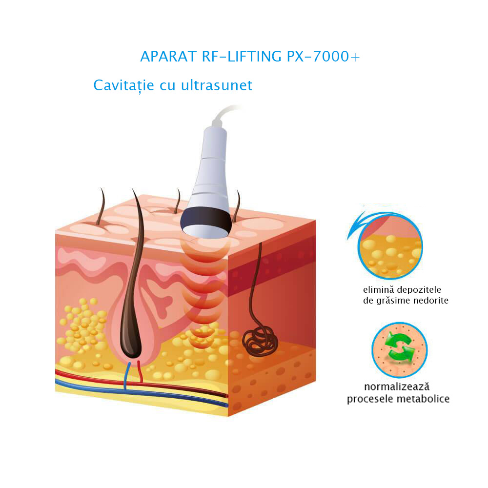 Cavitatie RF-lifting si vacuum PX-7000+ Alvi-Prague Combina pentru slabire
