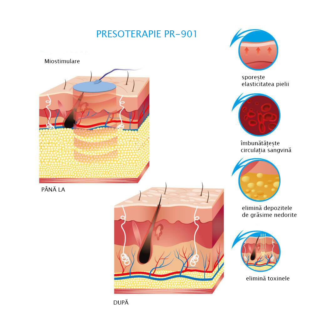 PR-901 aparat de presoterapie cu miostimulare si incalzire IR Alvi-Prague