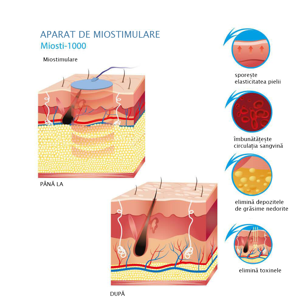 Moistimulare miosti-1000 Alvi-Prague