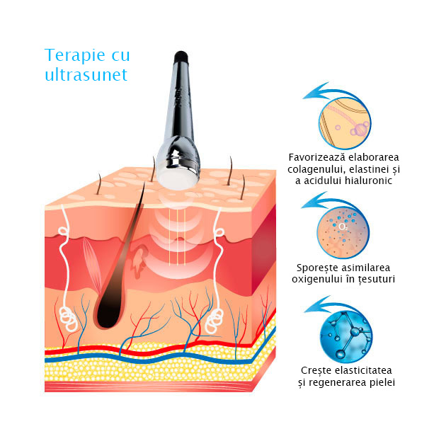 terapie cu ultrasunet fonofareza combina cosmetologica